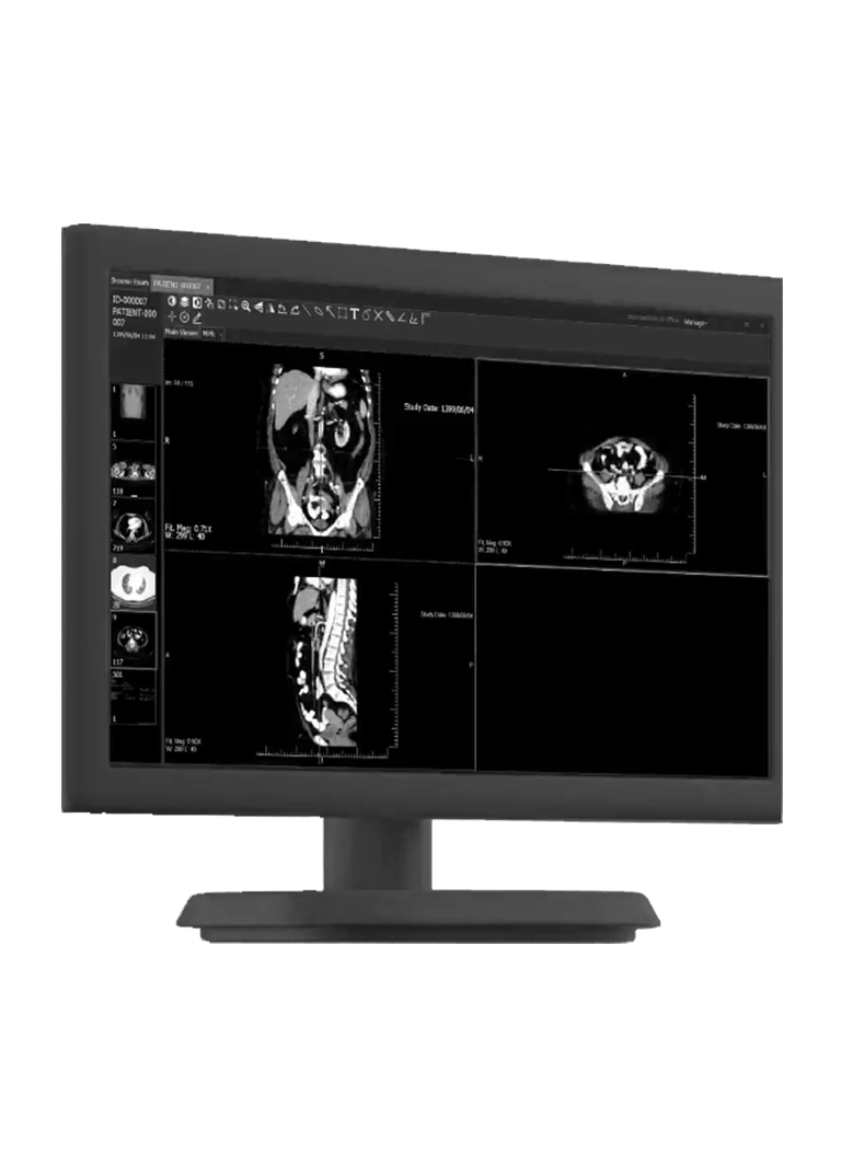 مارکو پکس (تحولات نوین یادمان)