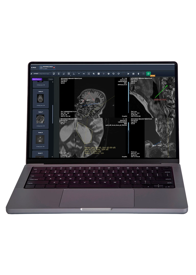 AI-PACS (برند اروپایی)